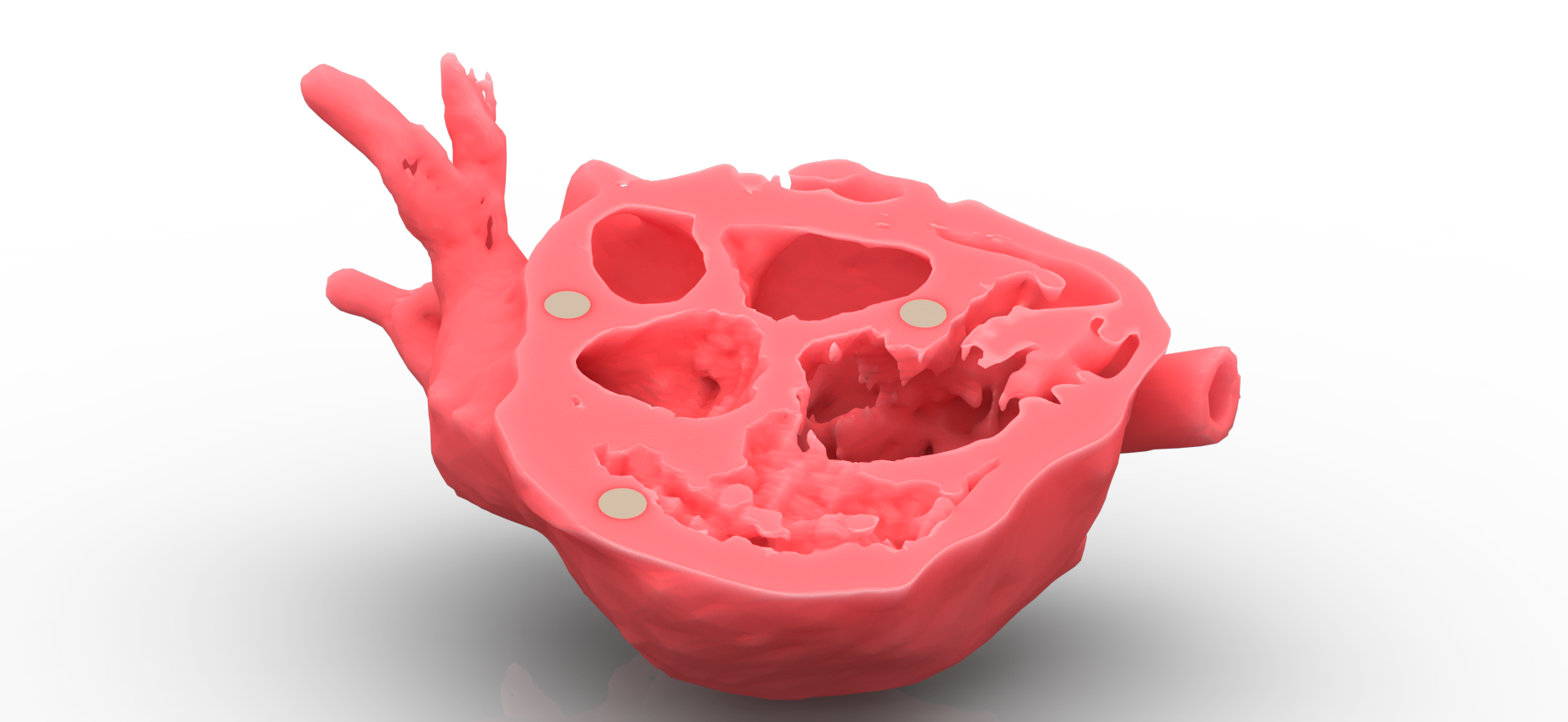 3D Printed Heart Section 1 of 3