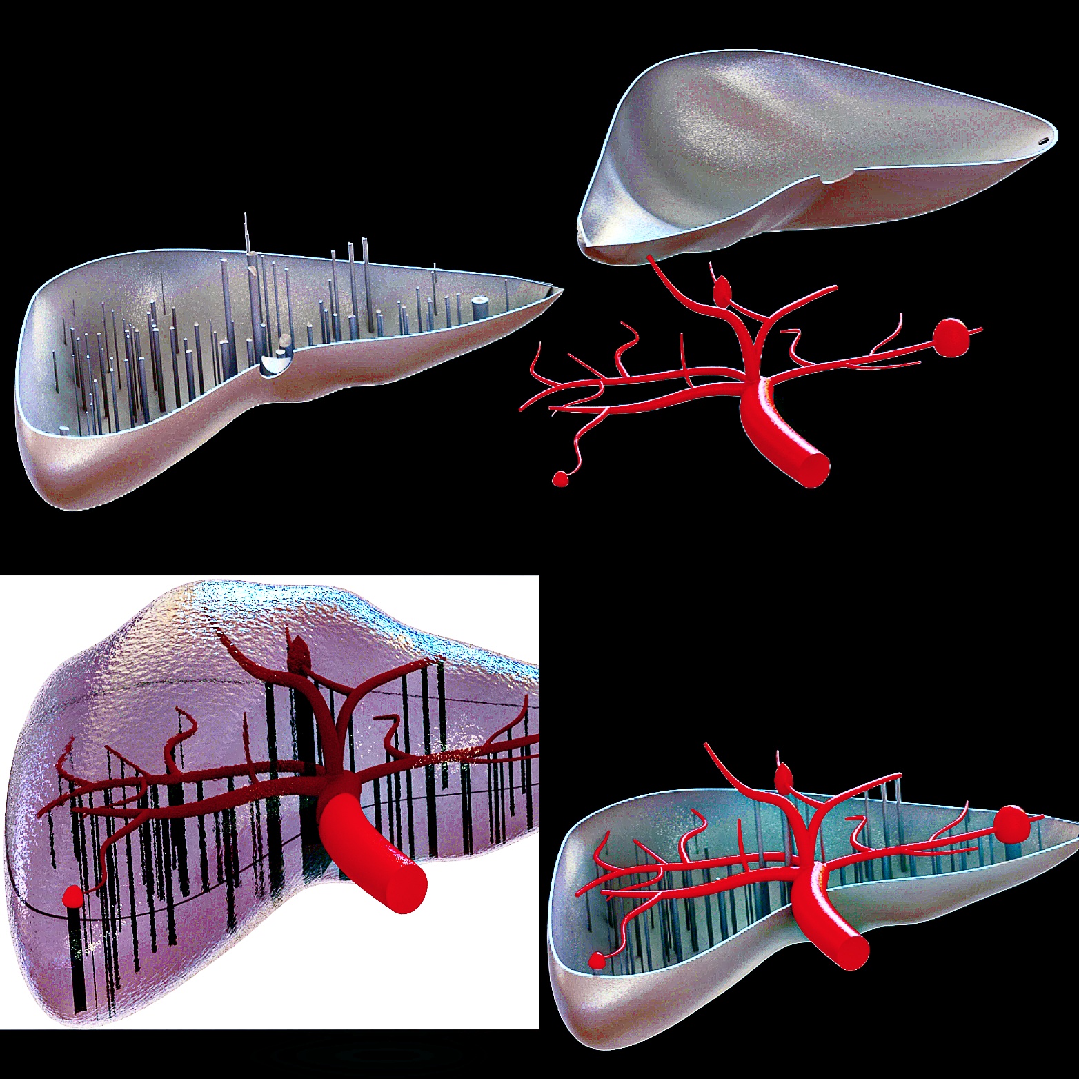 Liver with Tumors
