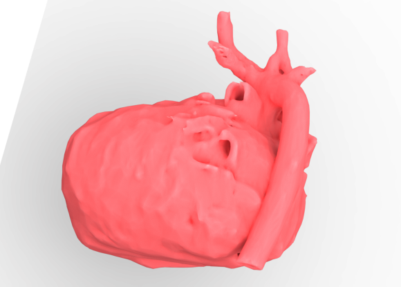 Human Heart