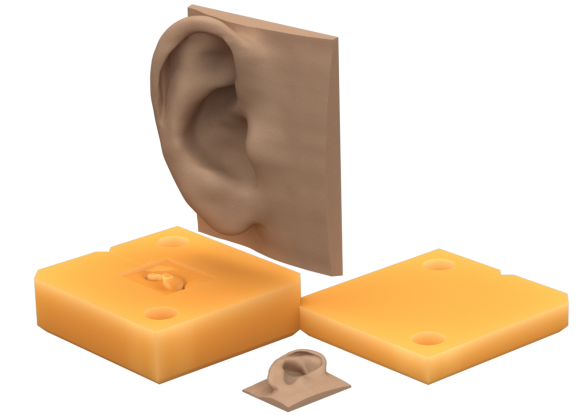 Prosthetic Ear Mold