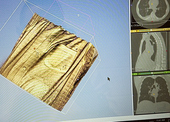 Human Torso Clothing CT Scan (Sample)