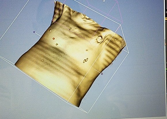 Human Torso Skin CT Scan (Sample)