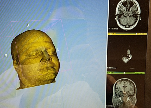 Human Head MRI Scan (Sample)