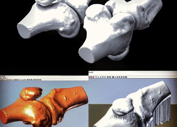 Knee Joint Model