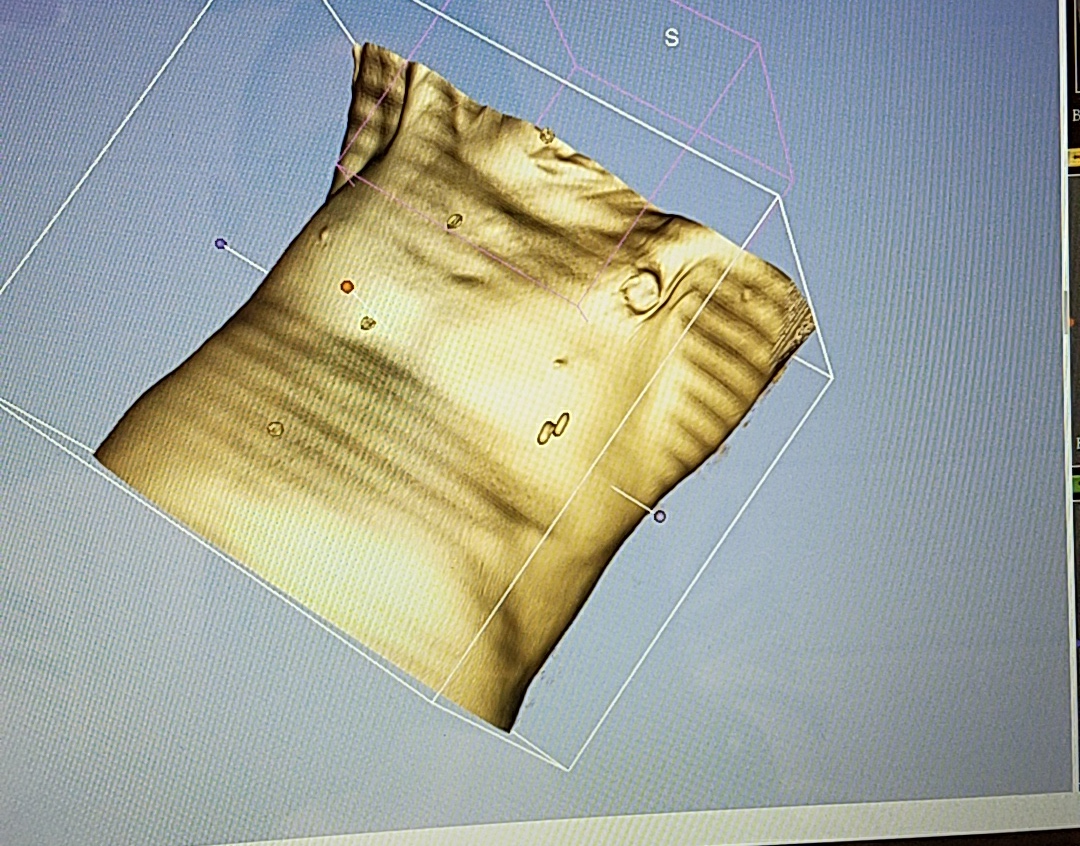 Human Torso Skin CT Scan (Sample)
